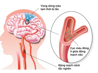 ROI LOAN TAM THAN THUC TON